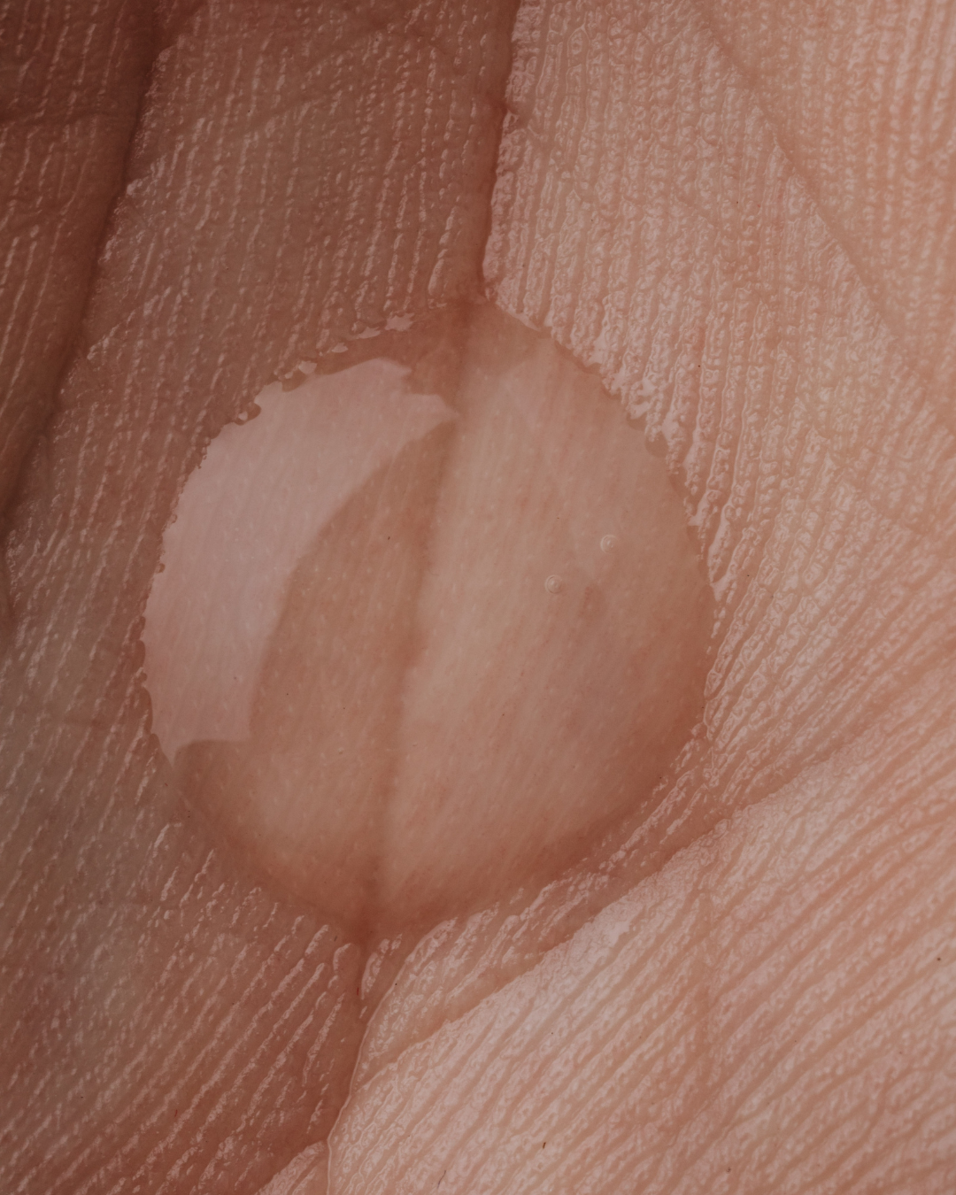 Why Your Skin Suddenly Becomes Sensitive (Even If It Never Was Before)